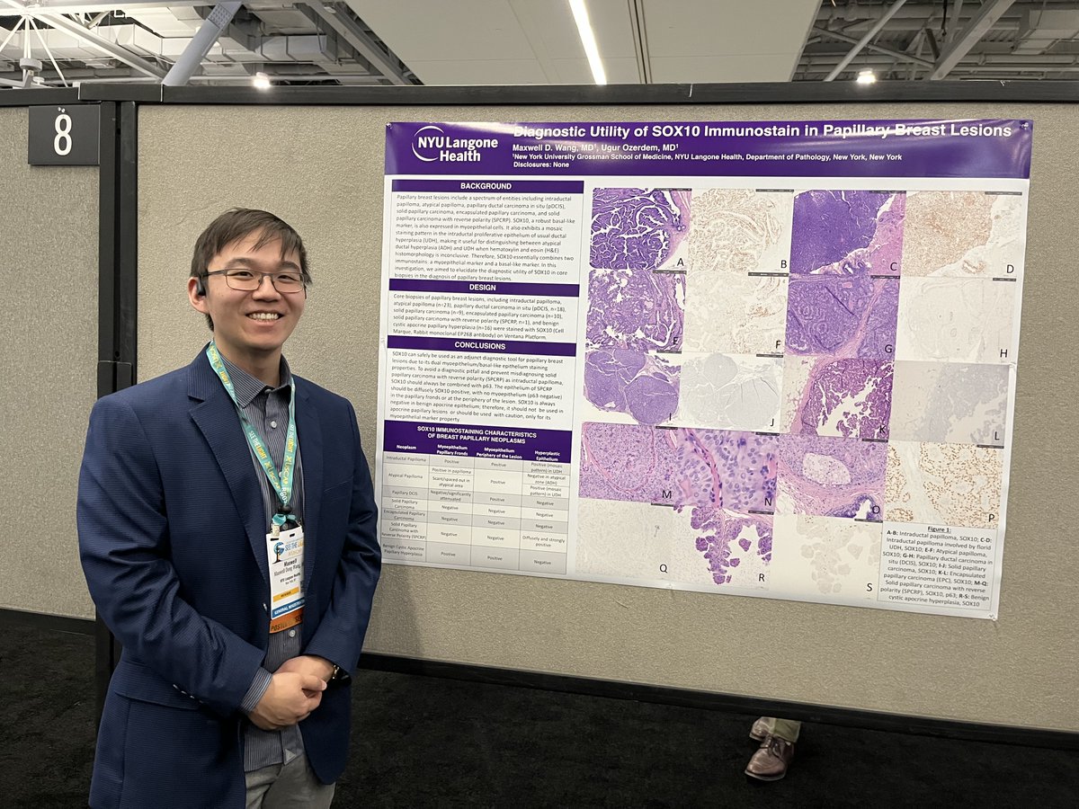 NYUGSOM Pathology Residency (@nyugsompathres) on Twitter photo More #USCAP2025 <a href="/NYUGSOM_Path/">NYU GSOM Pathology</a> posters! Dr. Elayna Shanker presented two studies: clinicopathologic features of Lichen Sclerosis, and LRG1 expression in endometrial carcinoma. Drs. Wang & Ozerdem presented their work on the diagnostic utility of SOX10 in papillary breast lesions. More #USCAP2025 <a href="/NYUGSOM_Path/">NYU GSOM Pathology</a> posters! Dr. Elayna Shanker presented two studies: clinicopathologic features of Lichen Sclerosis, and LRG1 expression in endometrial carcinoma. Drs. Wang & Ozerdem presented their work on the diagnostic utility of SOX10 in papillary breast lesions.