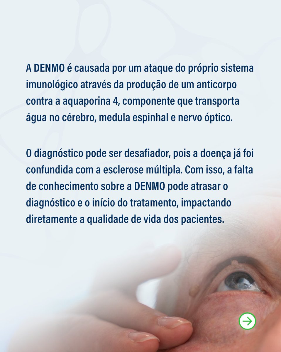 abneuro_'s tweet image. Juntos pela Conscientização da NMO! 💚
Pensando no avanço contínuo dos estudos na área de Neuroimunologia, temos uma novidade especial para você!
🏷️ Use o cupom MARÇOVERDE - EANI 2025
(desconto válido apenas até dia 10/04)
Acesse o site: abneuro.iweventos.com.br/eani2025