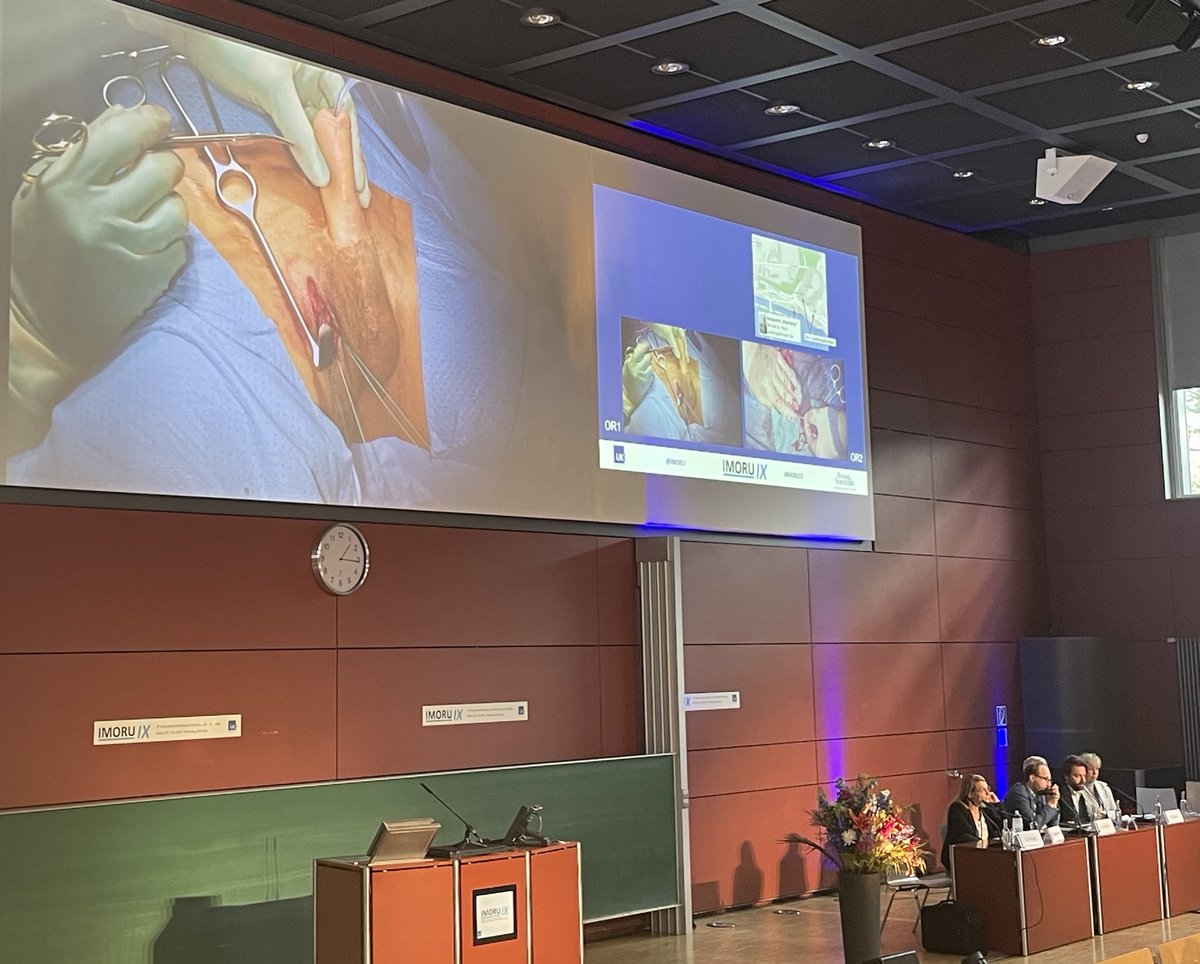 IMORU IX (@imoru) on Twitter photo Session 4 at #IMORU25 showcasing genital reconstruction. David Ralph 🇬🇧showcases corporoplasty using bovine pericardium, while <a href="/donwglee/">Wai Gin (Don) Lee</a> 🇬🇧 tackles a challenging Re-Re-Redo IPP in a trans-male after phalloplasty. Excellent discussions and fiery debates! 🔥 <a href="/UKEHamburg/">UKE Hamburg</a> Session 4 at #IMORU25 showcasing genital reconstruction. David Ralph 🇬🇧showcases corporoplasty using bovine pericardium, while <a href="/donwglee/">Wai Gin (Don) Lee</a> 🇬🇧 tackles a challenging Re-Re-Redo IPP in a trans-male after phalloplasty. Excellent discussions and fiery debates! 🔥 <a href="/UKEHamburg/">UKE Hamburg</a>