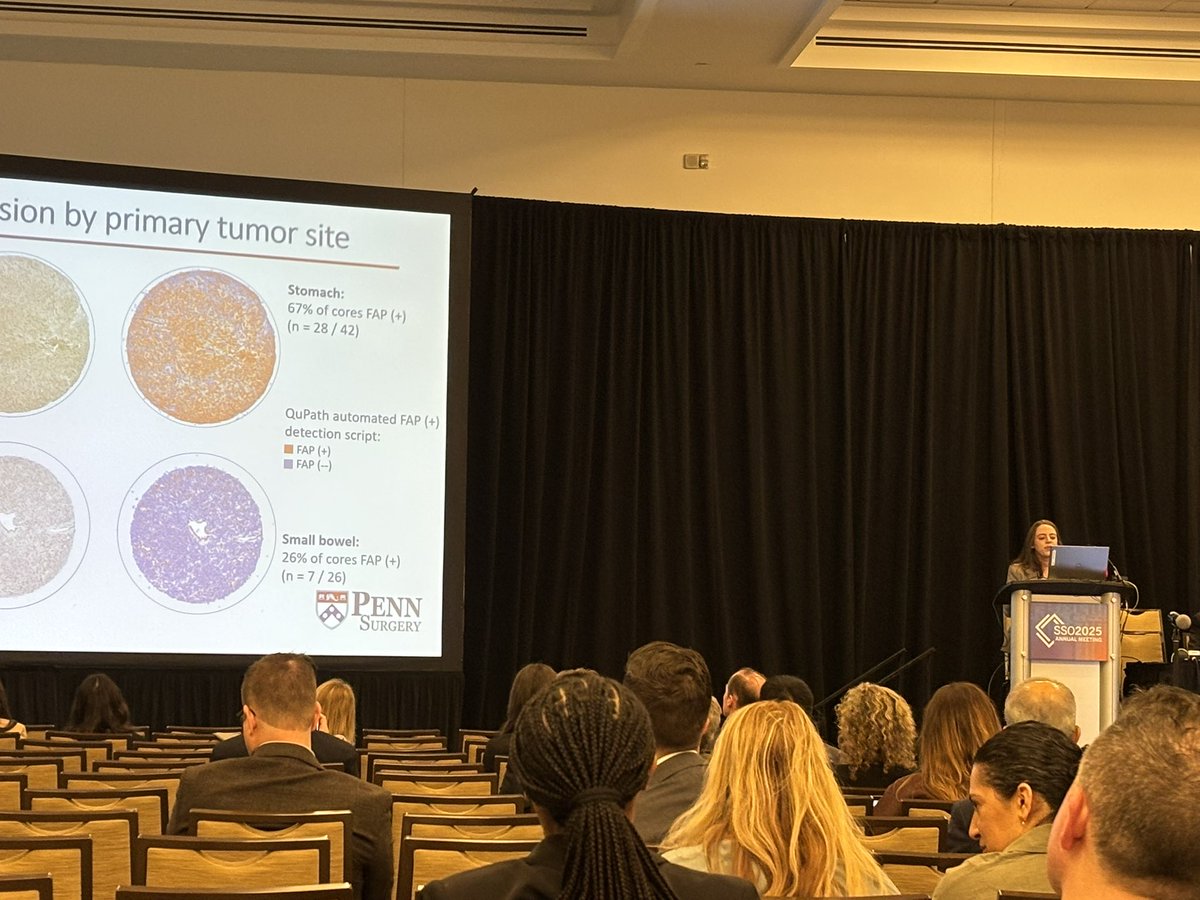 PennSurgery (@pennsurgery) on Twitter photo Our own <a href="/IuliaBarbur/">Iulia Barbur</a> superbly presents her work with the <a href="/dematteo_lab/">DeMatteoLab</a> on FAP expression in GIST #SSO2025 Our own <a href="/IuliaBarbur/">Iulia Barbur</a> superbly presents her work with the <a href="/dematteo_lab/">DeMatteoLab</a> on FAP expression in GIST #SSO2025