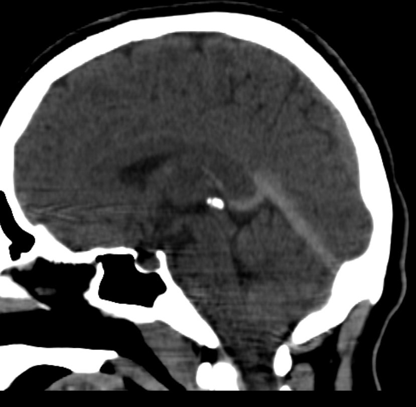 Neuromed tweet media