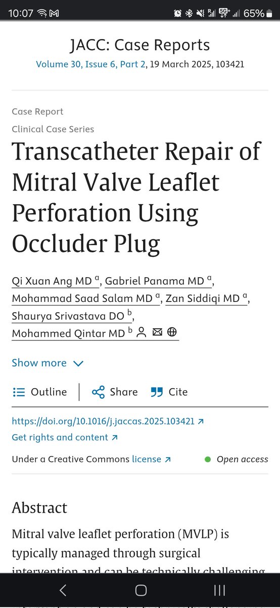 Ang Qi Xuan (Darian) (@drdarianqxang) on Twitter photo Excited to share that our case series on transcatheter repair of MV perforation using Amplatzer Duct Occluder II is now available on JACC! Big thanks to Dr <a href="/MohammedQintar/">Mohammed Qintar, MD MSc</a> and team for the great work!
doi.org/10.1016/j.jacc… Excited to share that our case series on transcatheter repair of MV perforation using Amplatzer Duct Occluder II is now available on JACC! Big thanks to Dr <a href="/MohammedQintar/">Mohammed Qintar, MD MSc</a> and team for the great work!
doi.org/10.1016/j.jacc…
