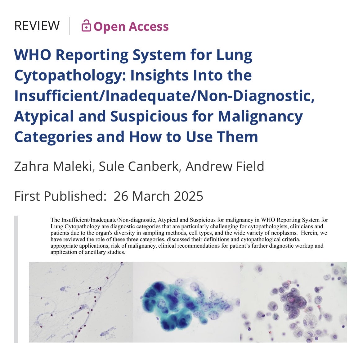 Zahra Maleki, MD, MIAC (@zmaleki_cyto) on Twitter photo Open access!!!
Fresh from the press!!!
<a href="/IACytology/">International Academy Cytology</a> <a href="/CytopathologyJ/">Cytopathology</a> <a href="/PVielh/">Philippe Vielh</a> <a href="/JHUPath/">Johns Hopkins Pathology</a> #lung #EBUS #cytology Open access!!!
Fresh from the press!!!
<a href="/IACytology/">International Academy Cytology</a> <a href="/CytopathologyJ/">Cytopathology</a> <a href="/PVielh/">Philippe Vielh</a> <a href="/JHUPath/">Johns Hopkins Pathology</a> #lung #EBUS #cytology