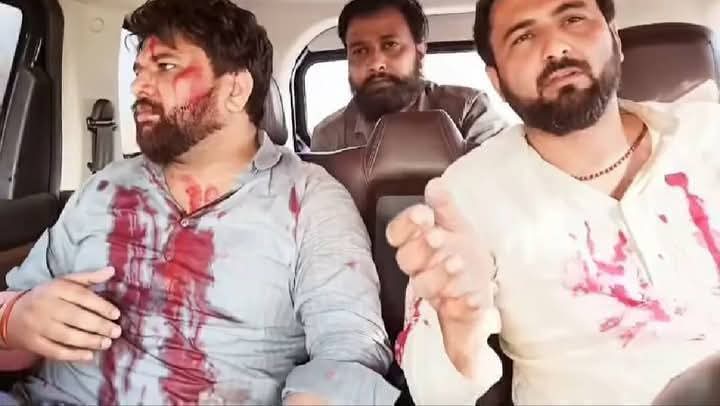 दलितों की राजधानी आगरा में करनी परणी सेना के ओकेंद्र राणा का उतर गया भूत

आगरा पुलिस ने अच्छी तरह स्वागत किया 

आप इनके बारे में अपनी राय जरूर दें