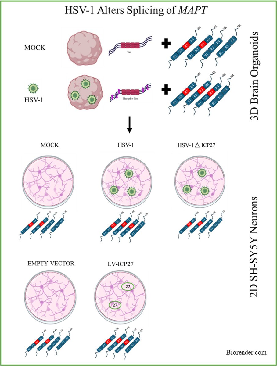 brainpathol's tweet image. Herpes simplex virus-1 infection alters microtubule-associated protein Tau splicing and promotes Tau pathology in neural models of Alzheimer's disease
onlinelibrary.wiley.com/doi/10.1111/bp…