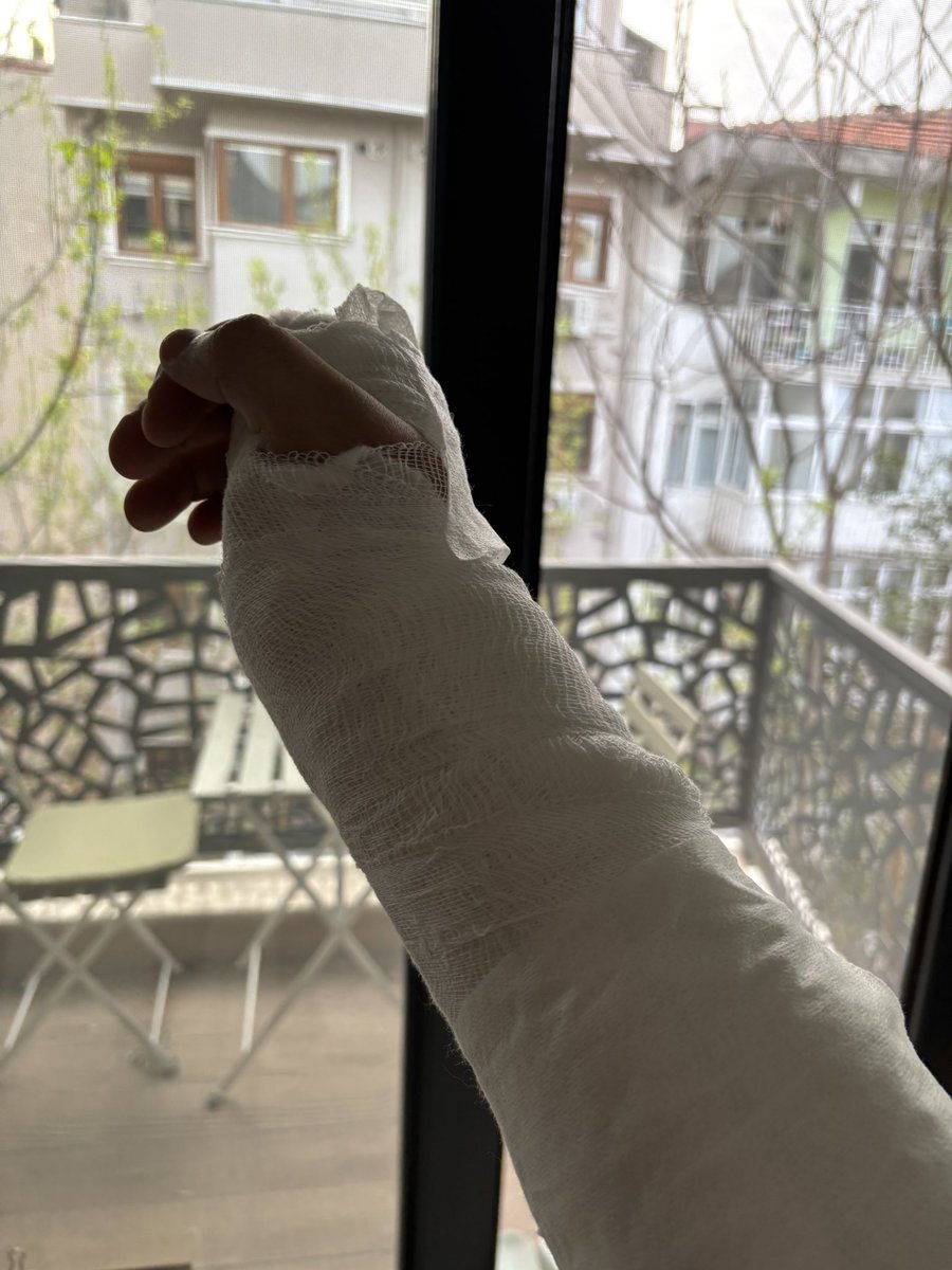 Kadıköy’ün orta yerinde Neşet Ömer sokakta yaralı bir sokak köpeğine mama verdim diye Akmarın arka girişindeki Pegasus Kitap isimli işletmede bulunan şahıs tarafından beyzbol sopası ile darp edildim. Kolum kırıldı ve ameliyatlara giremeyeceğim. Şikayetçi oldum, hakkımı arıyorum.