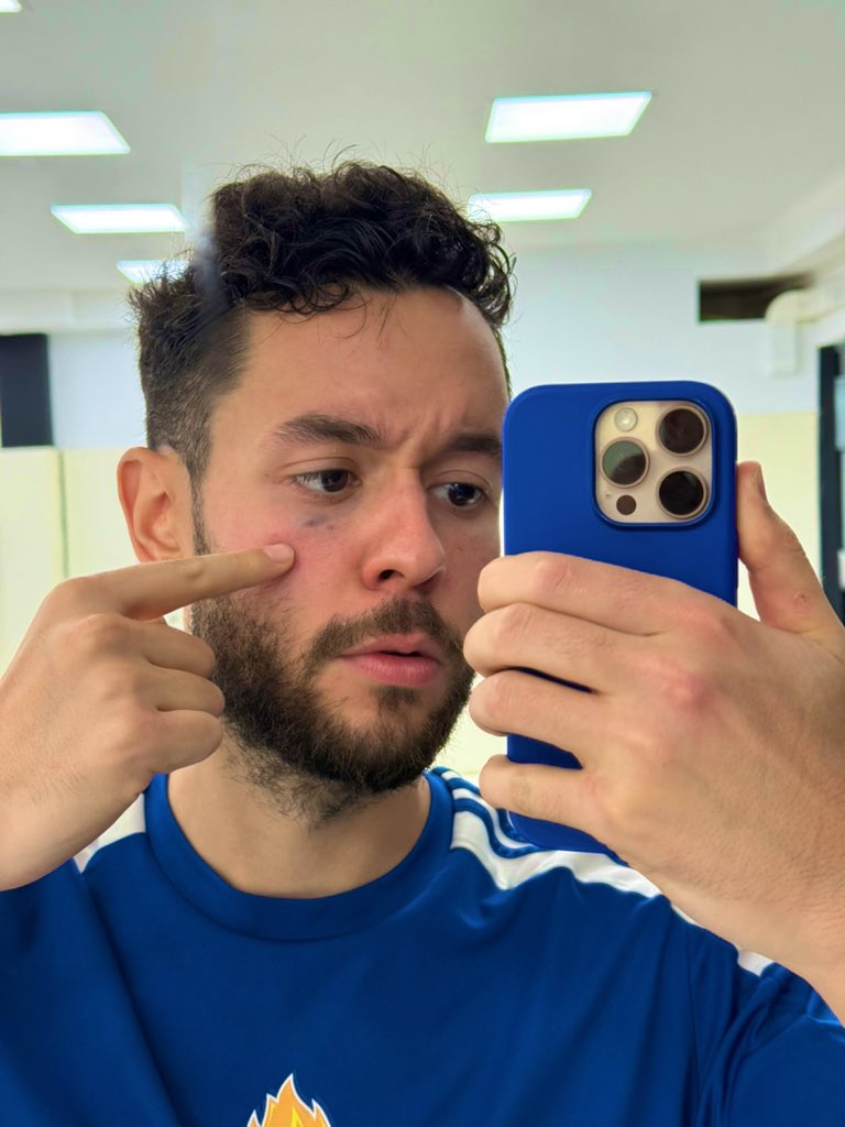 Grefg =) tweet media