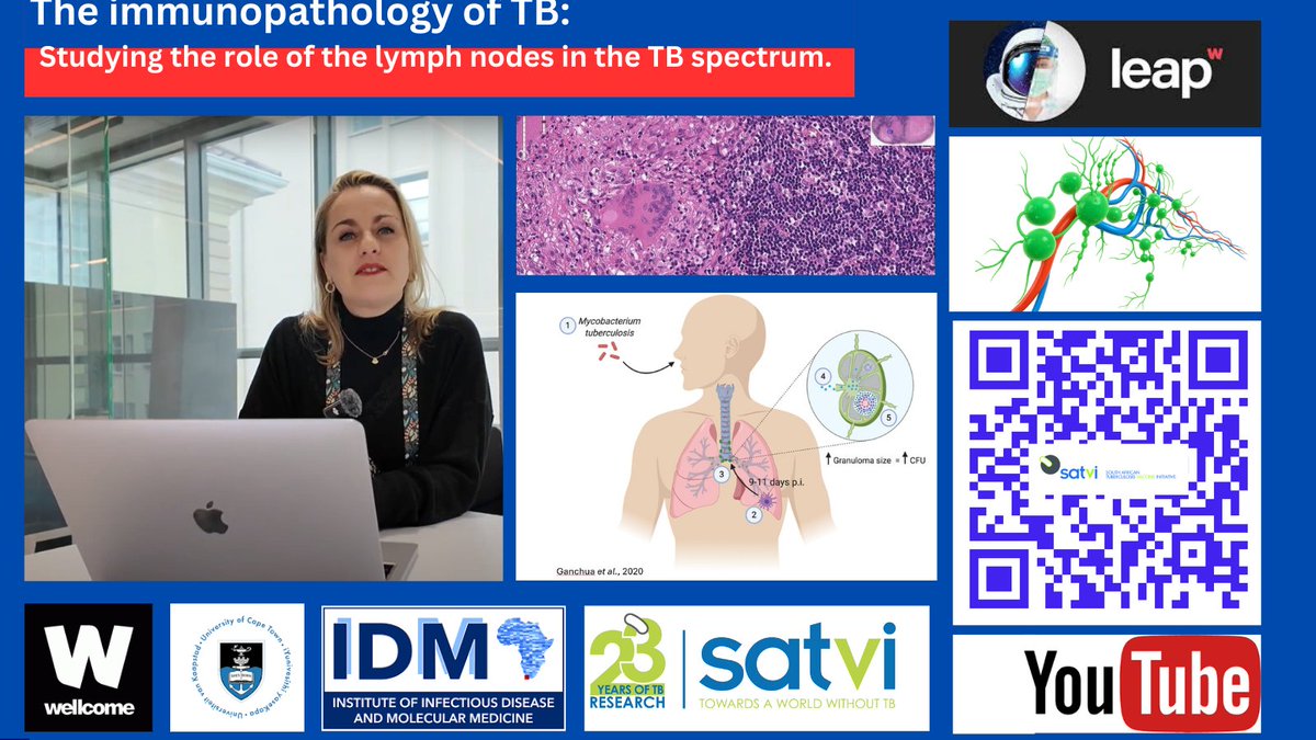 South African Tuberculosis Vaccine Initiative (@satvi_uct) on Twitter photo Immunopathology of TB: <a href="/satvi_uct/">South African Tuberculosis Vaccine Initiative</a> researchers discuss a groundbreaking study which investigates the role of lymph nodes in the context of mycobacterium tuberculosis infection and disease. The study was funded by a grant from <a href="/WellcomeLeap/">Wellcome Leap</a>. <a href="/wellcometrust/">Wellcome</a> youtu.be/8_gCOAfWUpw Immunopathology of TB: <a href="/satvi_uct/">South African Tuberculosis Vaccine Initiative</a> researchers discuss a groundbreaking study which investigates the role of lymph nodes in the context of mycobacterium tuberculosis infection and disease. The study was funded by a grant from <a href="/WellcomeLeap/">Wellcome Leap</a>. <a href="/wellcometrust/">Wellcome</a> youtu.be/8_gCOAfWUpw