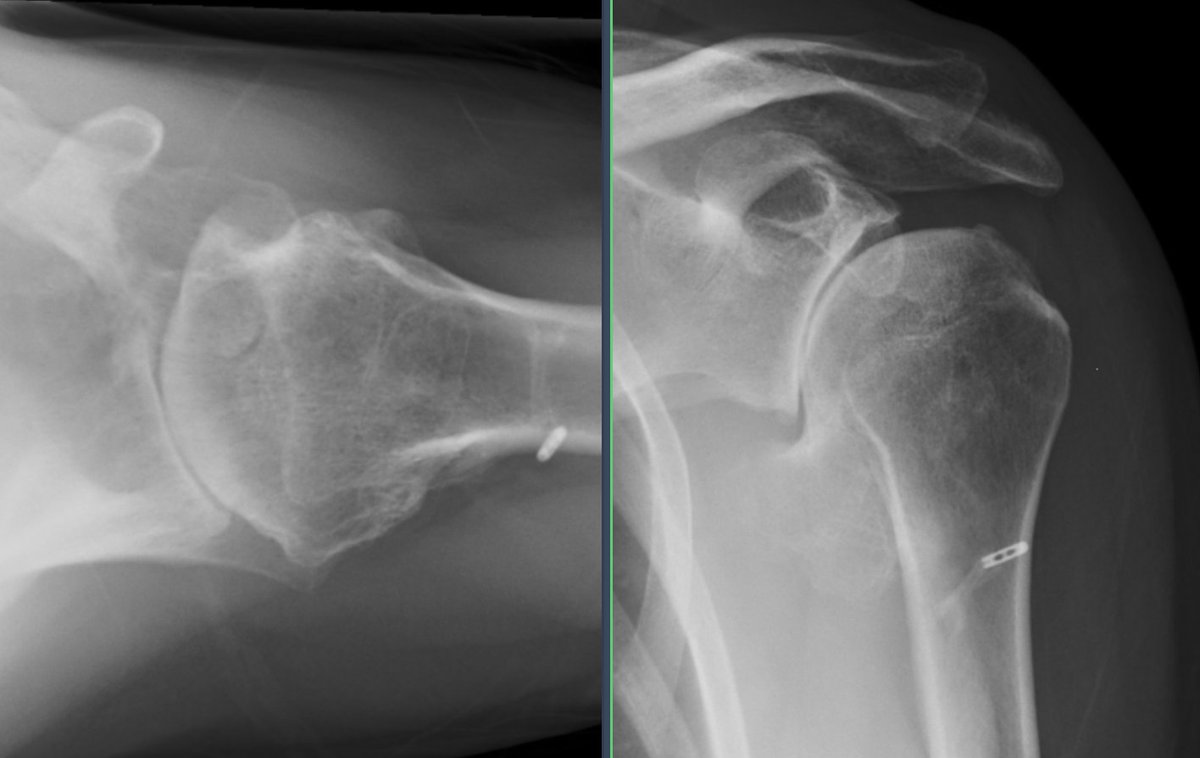 Rob Hartzler MD tweet media