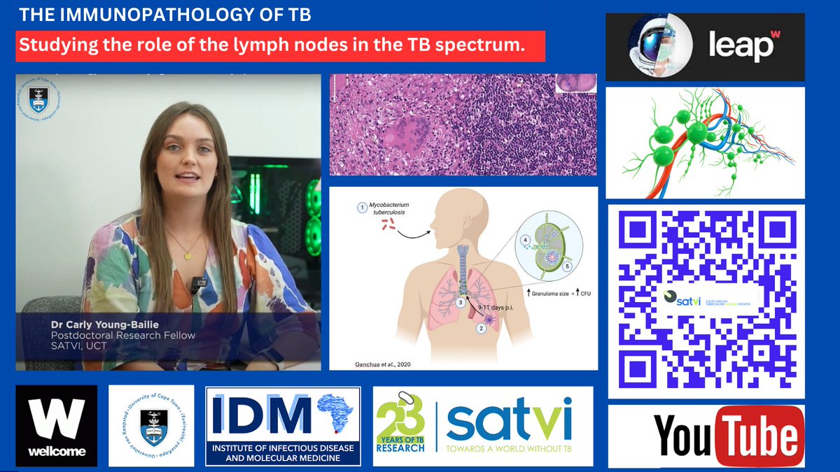 South African Tuberculosis Vaccine Initiative (@satvi_uct) on Twitter photo Immunopathology of TB:
<a href="/satvi_uct/">South African Tuberculosis Vaccine Initiative</a> researchers discuss a groundbreaking study which investigates the role of lymph nodes in the context of mycobacterium tuberculosis infection and disease. The study was funded by a grant from
<a href="/WellcomeLeap/">Wellcome Leap</a> <a href="/wellcometrust/">Wellcome</a> youtu.be/8_gCOAfWUpw Immunopathology of TB:
<a href="/satvi_uct/">South African Tuberculosis Vaccine Initiative</a> researchers discuss a groundbreaking study which investigates the role of lymph nodes in the context of mycobacterium tuberculosis infection and disease. The study was funded by a grant from
<a href="/WellcomeLeap/">Wellcome Leap</a> <a href="/wellcometrust/">Wellcome</a> youtu.be/8_gCOAfWUpw
