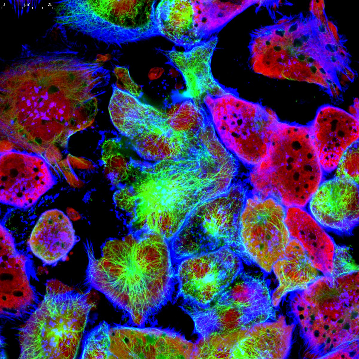 Cellular Art - immunofluorescence of tumor cells