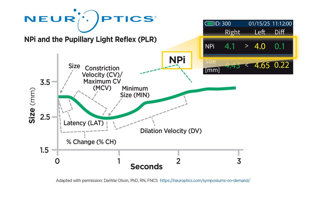 Pupillometry at a glance <a href="/NeurOpticsInc/">NeurOptics</a> #pupillometry