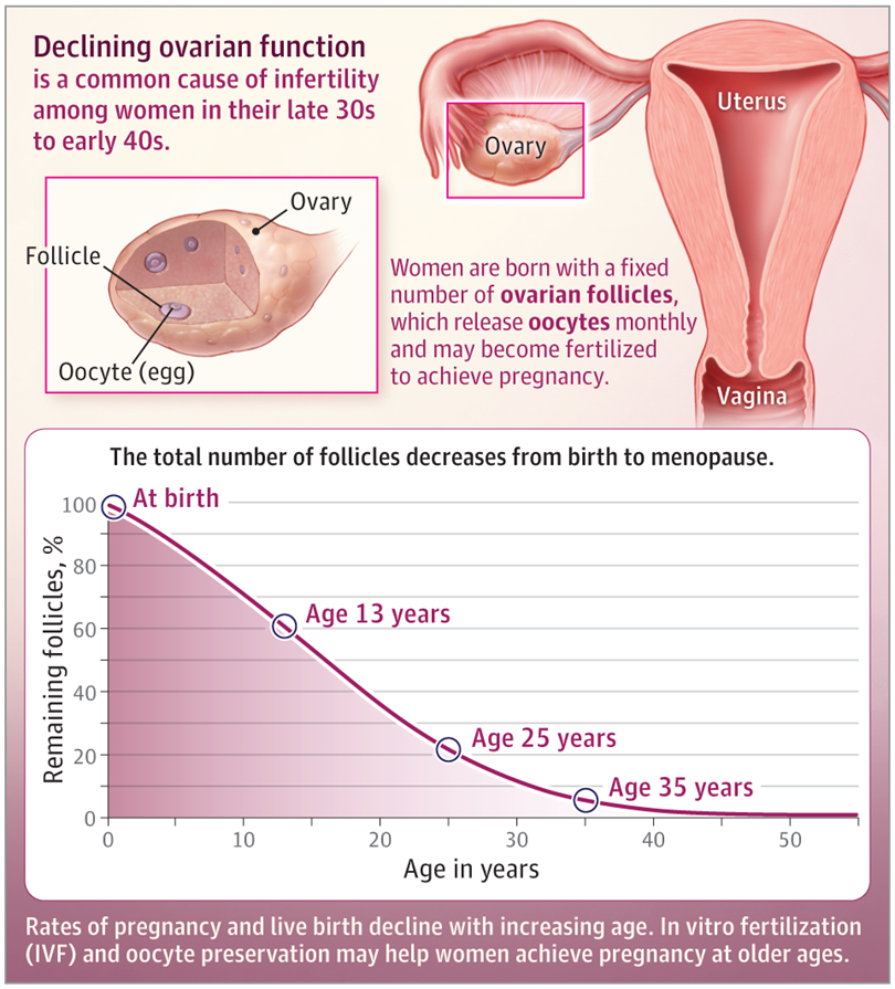 doctorneyro's tweet photo. Few #women achieve #livebirth with their own #oocytes after #45years despite optimal #diet, #exercise, and #invitrofertilization #IVF. 

Rates of #miscarriage are 12% in women #20to29years, 25% by #40y, 40% by #43y, nd 65% in #45years or #older.

https://t.co/ZtXsSFD1yZ https://t.co/XK5606oQrS