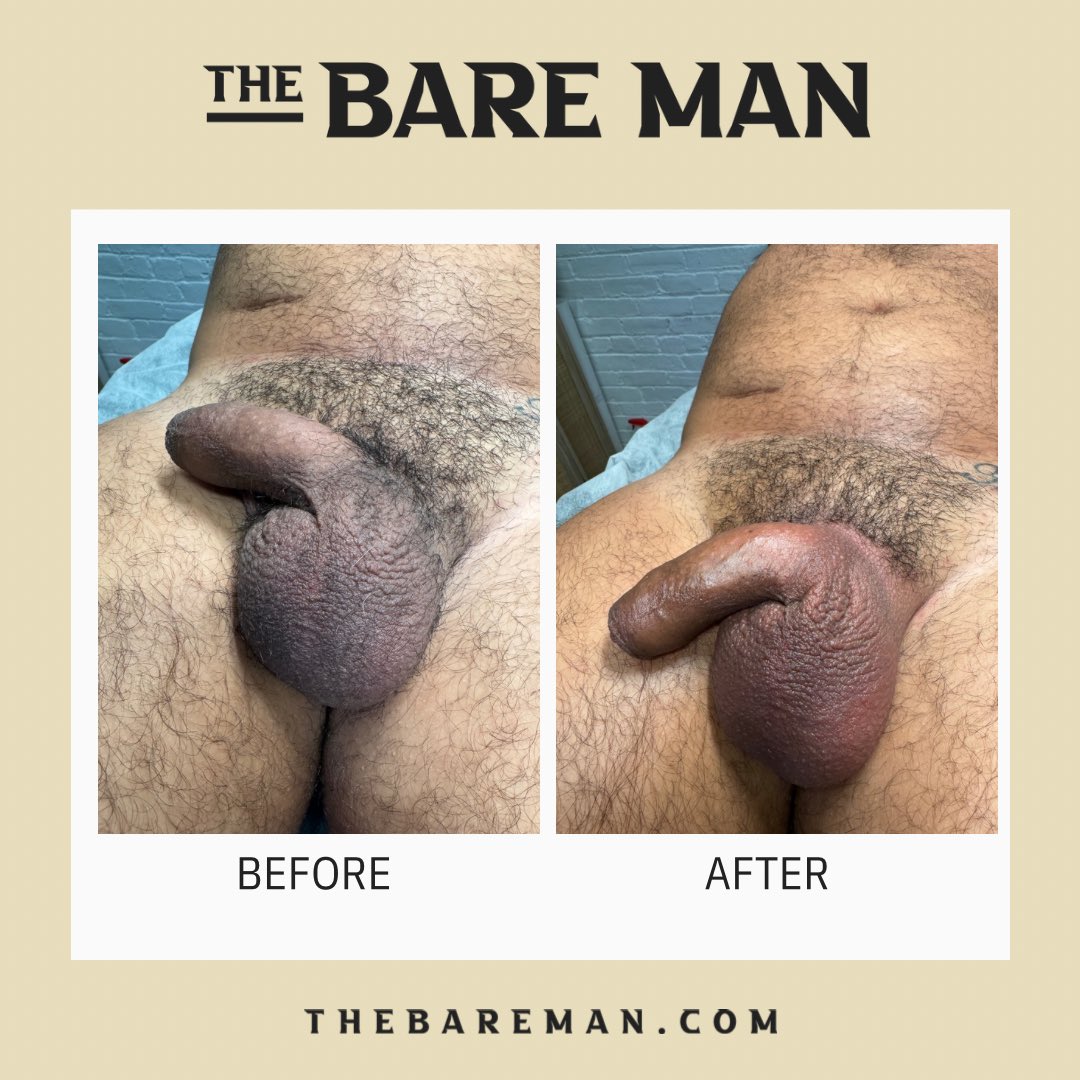 A little before and after action. Are you ready to be this smooth? Book your appointment thebareman.com #thebareman #malewaxing #beforeandafter