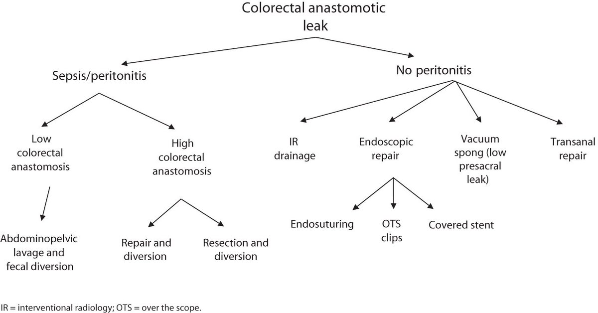 DCRjournal (@dcrjournal) on Twitter photo #DCRJournal Resident's Corner: Endoscopic and Transanal Management of Anastomotic Leak - bit.ly/3DAXYU3
<a href="/SoniaRamMD/">Sonia Ramamoorthy, MD FACS FASCRS</a> <a href="/justinmaykel/">Justin Maykel</a> <a href="/changtangMD/">Melissa I. Chang | 張愛文 MD, FACS, FASCRS</a> <a href="/luciacolorectal/">Lucia Oliveira,MD,PhD</a> <a href="/deanlute/">Dean Lutrin</a> <a href="/juliomayol/">Julio Mayol</a> <a href="/drjamestaylor/">James Taylor</a> <a href="/KarasJoshua/">Joshua R Karas MD</a> <a href="/MaloneyNell/">Nell Maloney Patel</a> <a href="/Averywalker21/">Avery Walker, MD, FACS, FASCRS</a> #DCRJournal Resident's Corner: Endoscopic and Transanal Management of Anastomotic Leak - bit.ly/3DAXYU3
<a href="/SoniaRamMD/">Sonia Ramamoorthy, MD FACS FASCRS</a> <a href="/justinmaykel/">Justin Maykel</a> <a href="/changtangMD/">Melissa I. Chang | 張愛文 MD, FACS, FASCRS</a> <a href="/luciacolorectal/">Lucia Oliveira,MD,PhD</a> <a href="/deanlute/">Dean Lutrin</a> <a href="/juliomayol/">Julio Mayol</a> <a href="/drjamestaylor/">James Taylor</a> <a href="/KarasJoshua/">Joshua R Karas MD</a> <a href="/MaloneyNell/">Nell Maloney Patel</a> <a href="/Averywalker21/">Avery Walker, MD, FACS, FASCRS</a>