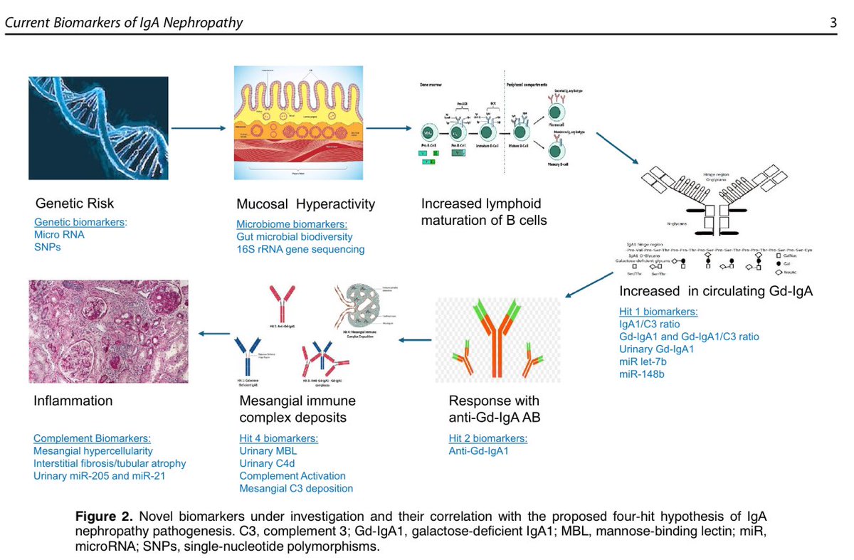 🧬#IgANephropathy: Can we predict who will progress to ESKD? 🫘🔍

New biomarkers—Gd-IgA1, microRNAs, complement activation—are reshaping diagnosis &amp; prognosis. 

🔗 doi.org/10.1016/j.semn… 🆕 

#Nephrology #IgAN #Biomarkers #MedTwitter