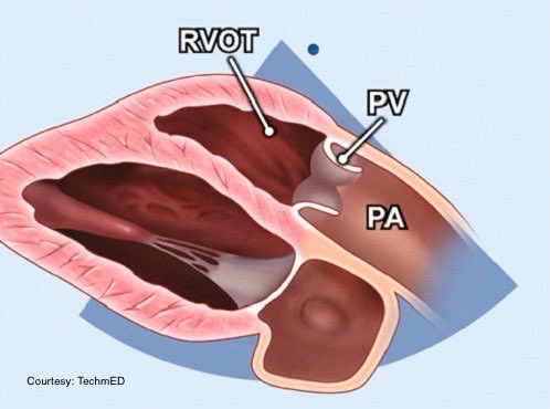 Good example, not always possible to get.
#POCUS #MedEd