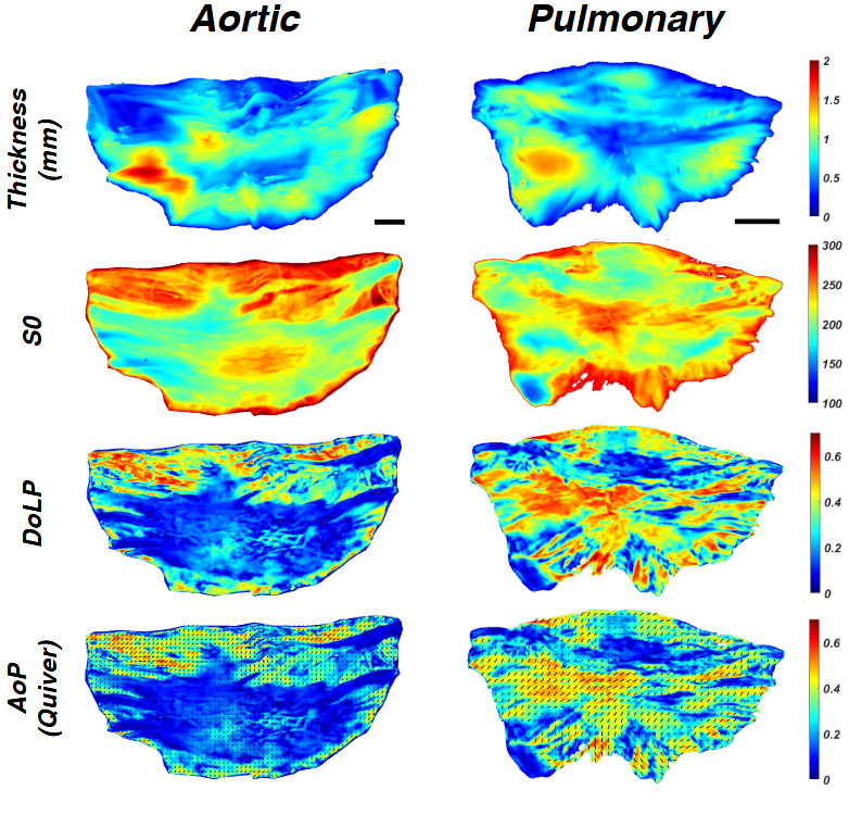 🚨New paper alert🚨- excited to share our publication in the Journal of Biophotonics (pubmed.ncbi.nlm.nih.gov/40051274/)  Great work from Shreya Sreedhar and Daniel Pearce on the dynamic full-field structure of aortic and pulmonary valve leaflets! Congratulations!