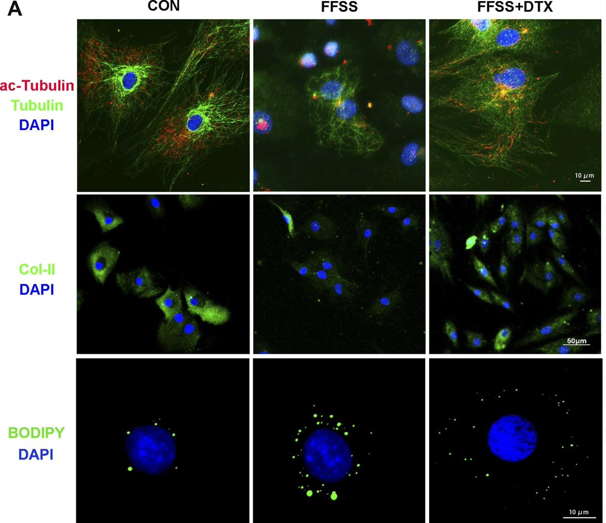 #New #OAC #March This work by Yu et al., investigates the impact of stress-induced microtubule impairment on intracellular transport and lipid droplet (LD) accumulation in chondrocytes.  🧪 🥼 
🔗 buff.ly/2Zxh1CM
