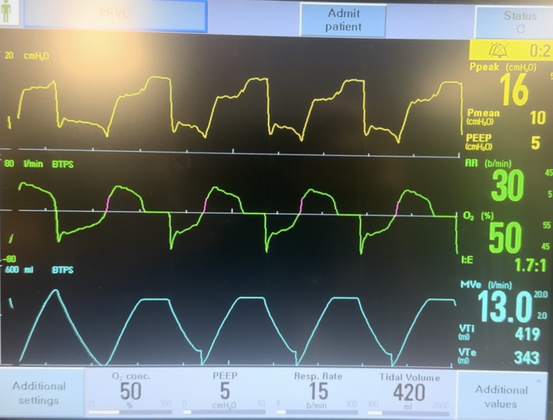 Here’s the ventilator graphic from a patient who was intubated for airway protection

What problems do you see?