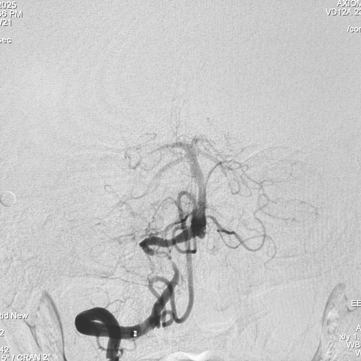 Sometimes, a change in perspective can be significant.