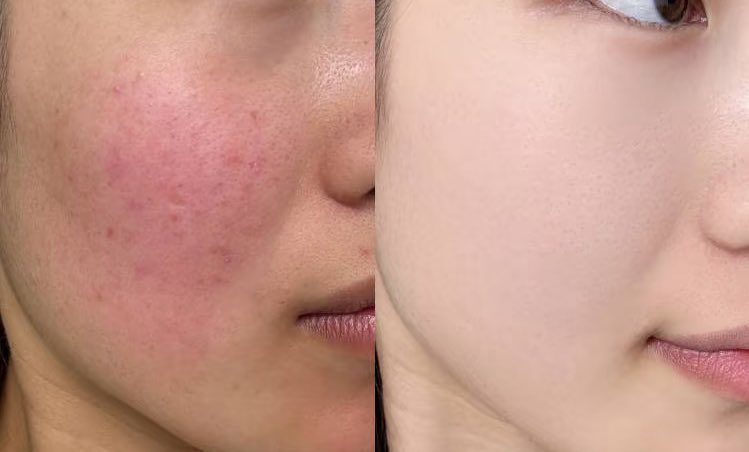 ℝ𝕒𝕟𝕟𝕒🐰🫧 tweet media