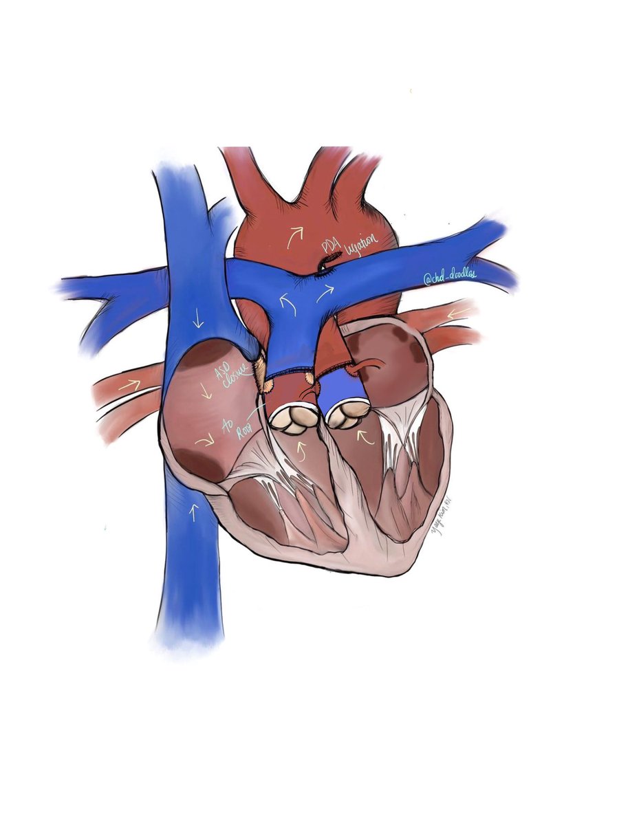 Rawan Amir (@rawanaamir) on Twitter photo <a href="/CardioNerds/">CardioNerds</a> <a href="/ClaireCambron/">Claire Cambron</a> <a href="/jsaef1/">Josh Saef</a> <a href="/T_GuptaMD/">Tripti Gupta</a> Category: Arterial Anomalies Artwork
From twists and turns to abnormal paths, these art pieces brought arterial variations to life 🤩
Congratulations to our winner 🏆 Yaeji Kim
<a href="/CardioNerds/">CardioNerds</a> <a href="/ClaireCambron/">Claire Cambron</a> <a href="/jsaef1/">Josh Saef</a> <a href="/T_GuptaMD/">Tripti Gupta</a> <a href="/CardioNerds/">CardioNerds</a> <a href="/ClaireCambron/">Claire Cambron</a> <a href="/jsaef1/">Josh Saef</a> <a href="/T_GuptaMD/">Tripti Gupta</a> Category: Arterial Anomalies Artwork
From twists and turns to abnormal paths, these art pieces brought arterial variations to life 🤩
Congratulations to our winner 🏆 Yaeji Kim
<a href="/CardioNerds/">CardioNerds</a> <a href="/ClaireCambron/">Claire Cambron</a> <a href="/jsaef1/">Josh Saef</a> <a href="/T_GuptaMD/">Tripti Gupta</a>