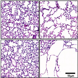 endothelialnews's tweet photo. How does PRMT1 affect #endothelial cells in the context of #COPD? 🤔
Researchers show that by suppressing NF-κB activation and preventing inflammatory shifts, PRMT1 protects against endothelial dysfunction, inflammation, and senescence in COPD.
https://t.co/HWX8AValgs https://t.co/G6n0PRwbBr