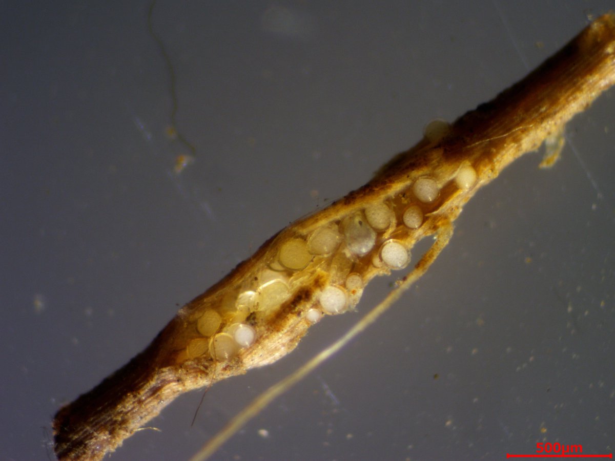 根の中に胞子を形成するアーバスキュラー菌根菌もいますから