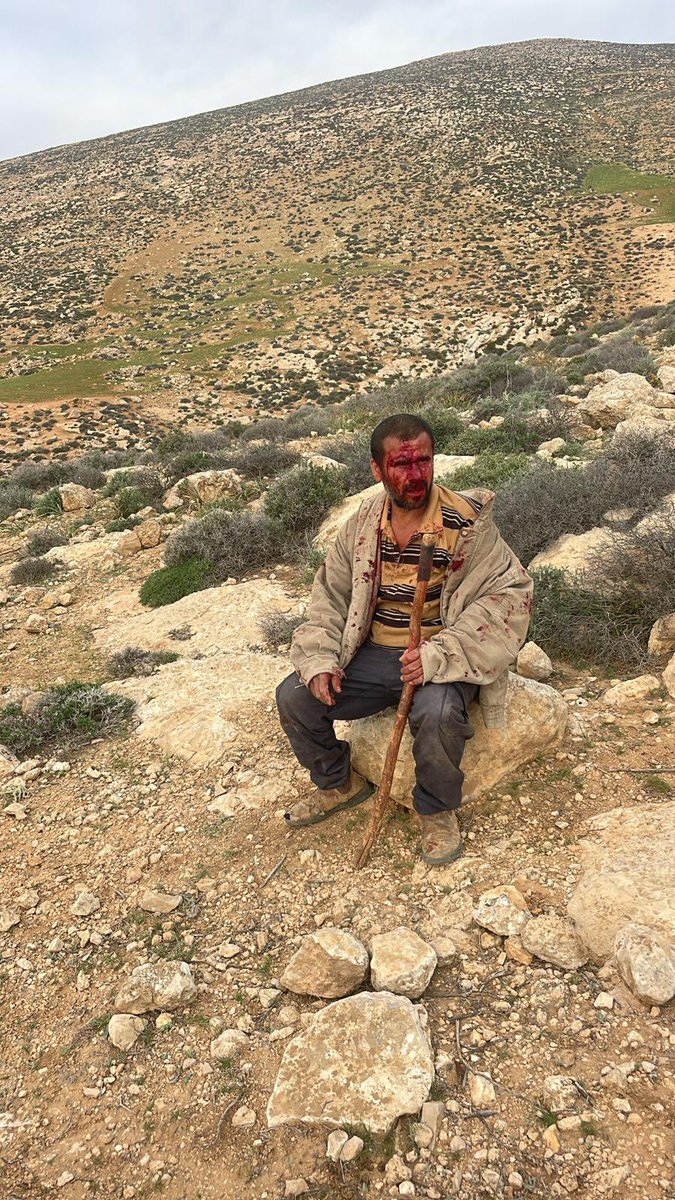 HurainiSami's tweet image. Few moments ago Israeli settlers attacked the shepherd Maher from Jinba village in
Masafer Yatta , ongoing daily crimes by Israeli occupation settlers and soldiers , with out accountability this terror will never stop against us #holdisraelaccoubtable #savemasaferyatta