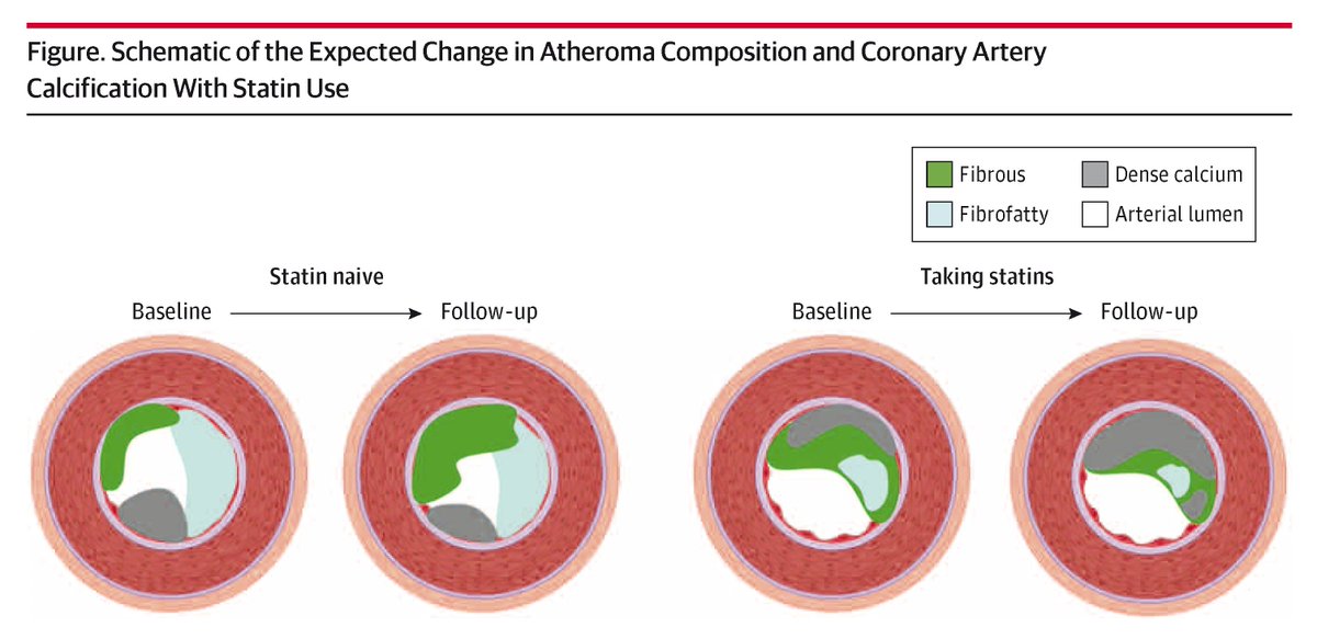 JAMACardio's tweet photo. Most viewed from @JAMACardio:

Measurement of coronary artery calcium (CAC) score among adults without ASCVD and of intermediate risk, as well as borderline risk in certain cases, can help refine risk stratification when a clinical decision is uncertain.

https://t.co/FdWsH2M1iN https://t.co/NY6qdAdDEe