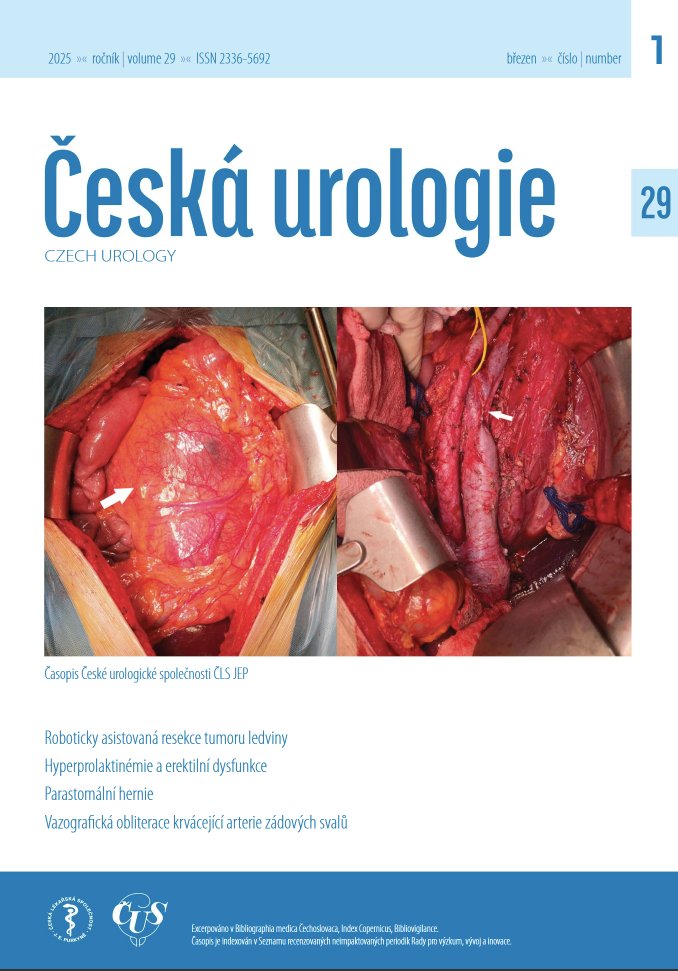 Czech urology (@czechurology) on Twitter photo První číslo <a href="/CzechUrology/">Czech urology</a> s novým nakladatelem Care Comm carecomm.cz je na světě. czechurol.cz/en/magno/cur/2…
Robotická resekce tumoru ledviny, hernie u Brickera, hyperprolaktinemie u ED, cytologie moče u nádorů horních cest močových... <a href="/CUS_CLS_JEP/">ČUS #uroczech</a> #uroczech První číslo <a href="/CzechUrology/">Czech urology</a> s novým nakladatelem Care Comm carecomm.cz je na světě. czechurol.cz/en/magno/cur/2…
Robotická resekce tumoru ledviny, hernie u Brickera, hyperprolaktinemie u ED, cytologie moče u nádorů horních cest močových... <a href="/CUS_CLS_JEP/">ČUS #uroczech</a> #uroczech