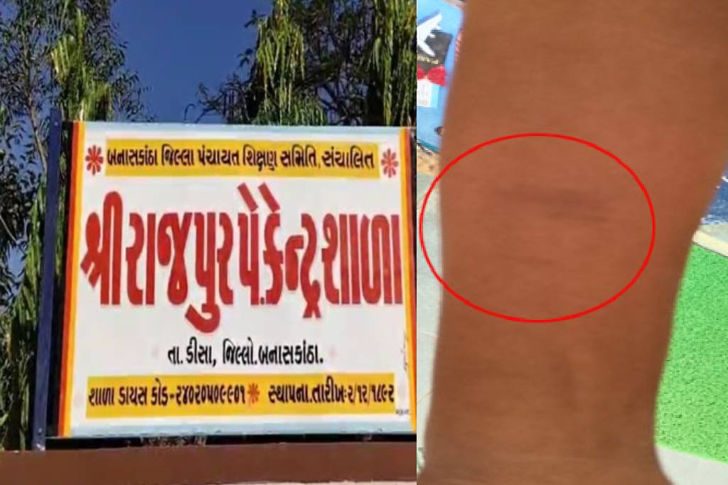 After Bagasara, students in Deesa school cut hands with blades