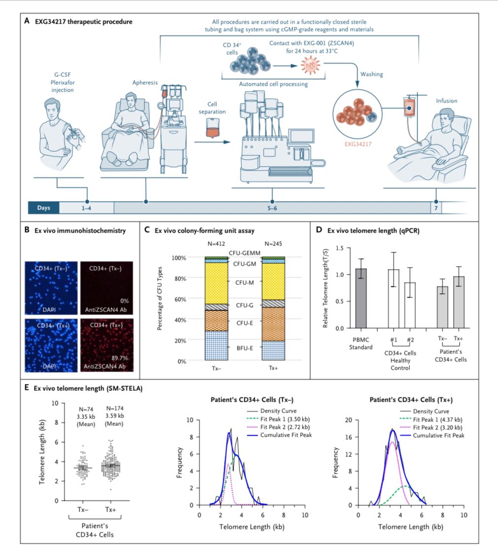 Gene therapy for #telomere biology disorders 🧬! Report of first 2 patients <a href="/NEJMEvidence/">NEJM Evidence</a> by Kas Myers using vector to increase expression of ZSCAN4 to elongate telomeres. Some TL elongation in HSPCs but low numbers. Will be interested to see more data! evidence.nejm.org/doi/pdf/10.105…