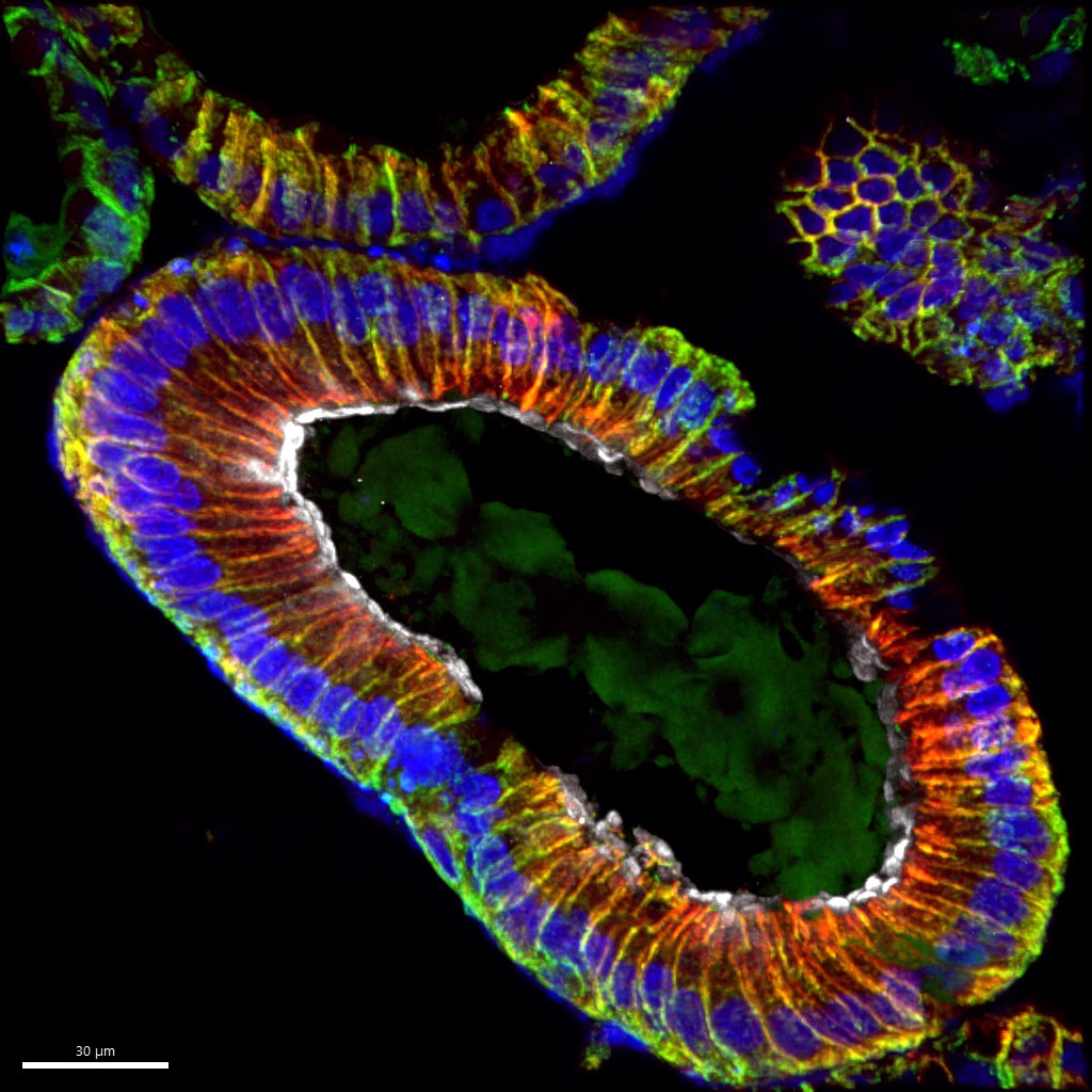 Human  colonoid organoid stained for NHE3 (white) CDH1 (green) and CDH17 (red). #FluorescenceFriday #sciart #bioart #organoids