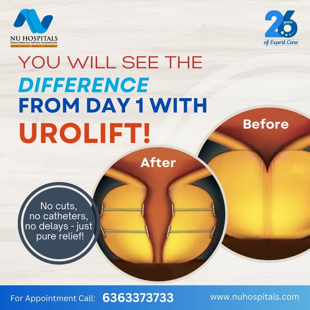 🔹 Say goodbye to frequent bathroom trips &amp; weak flow - UroLift restores natural urination effortlessly
 🔹 Zero impact on sexual function 
 🔹 Minimally invasive, safe, and stress-free - get treated &amp; walk out the same day
 🔹 A quick, proven solution for BPH (enlarged prostate