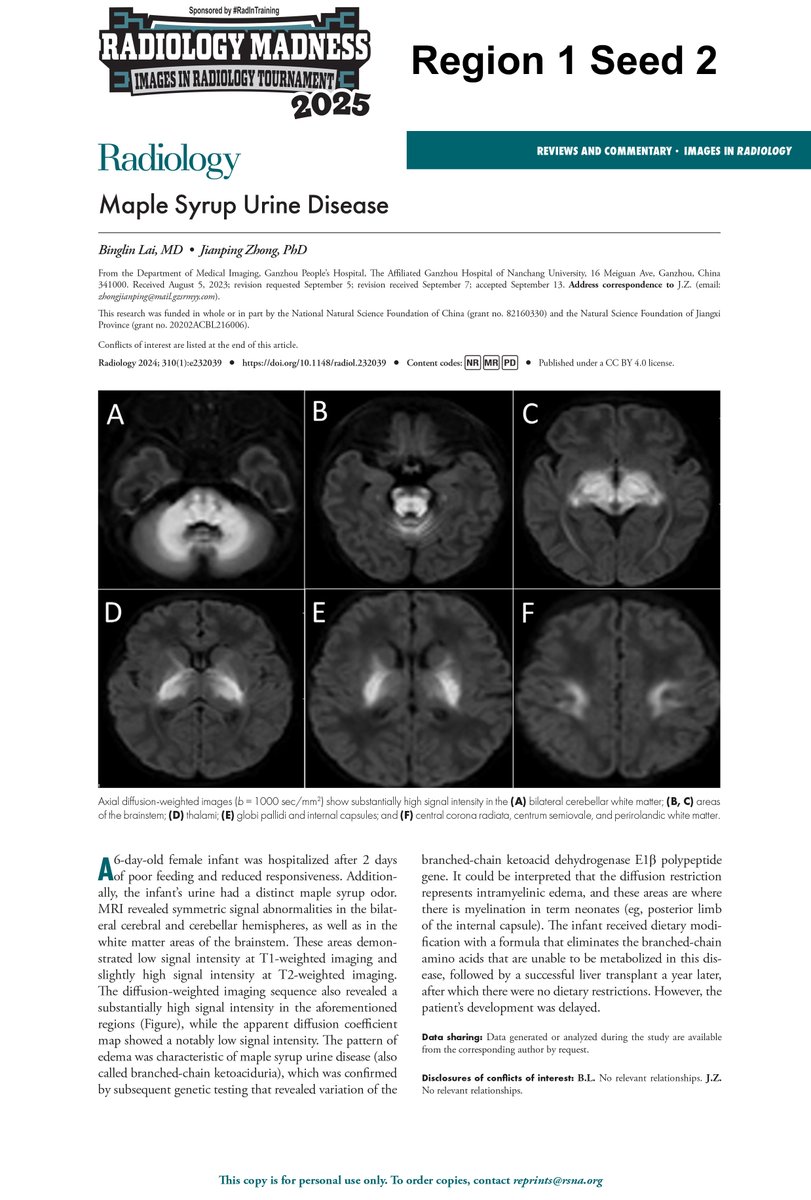 #RadiologyMadness presented by #RadinTraining

Region 1 FINALS

Diagnosis 8 vs Diagnosis 2

VOTE BELOW!
