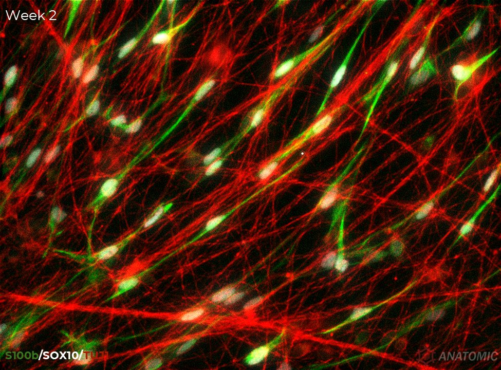 AnatomicTech's tweet image. 💡 Enhance your research! Integrate Schwann cell precursors (SCPs) into your motor neuron (MNs) cultures

As SCPs mature, they migrate &amp;amp; align along axons, visualized using immunofluorescent staining—S100b/SOX10 (SCPs) &amp;amp; TUJ1 (MNs)

#CompleteTheCircuit #ALSResearch