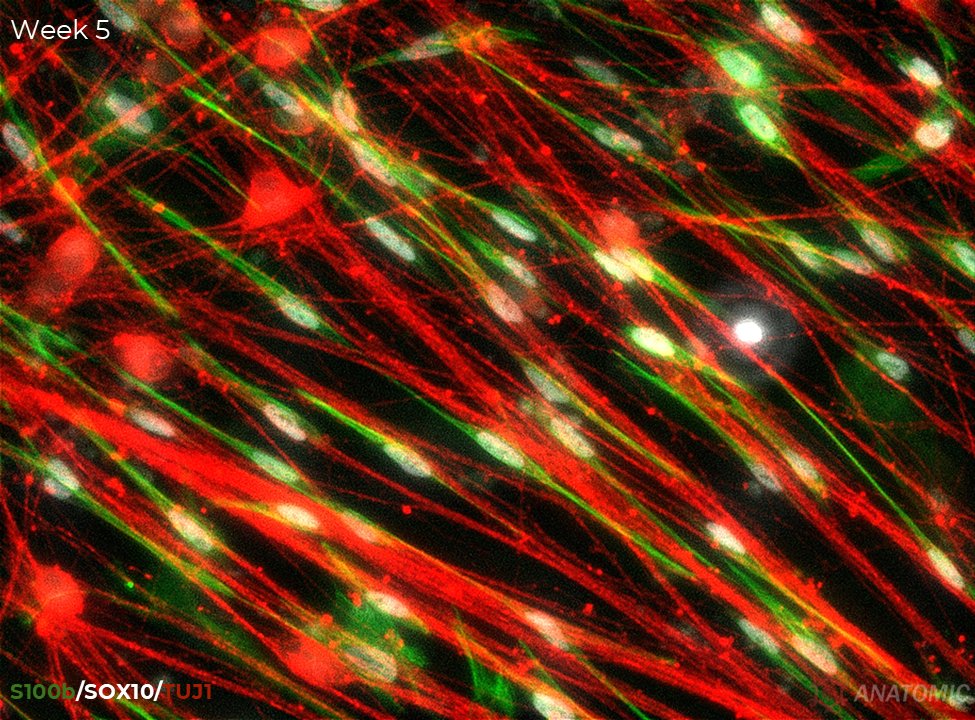 AnatomicTech's tweet image. 💡 Enhance your research! Integrate Schwann cell precursors (SCPs) into your motor neuron (MNs) cultures

As SCPs mature, they migrate &amp;amp; align along axons, visualized using immunofluorescent staining—S100b/SOX10 (SCPs) &amp;amp; TUJ1 (MNs)

#CompleteTheCircuit #ALSResearch