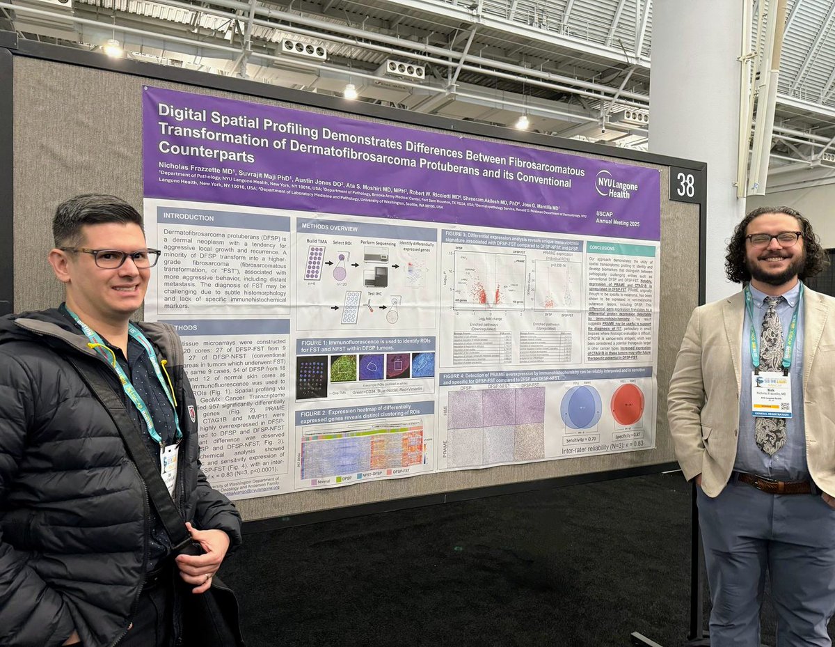 NYUGSOM Pathology Residency (@nyugsompathres) on Twitter photo More great posters from <a href="/NYUGSOM_Path/">NYU GSOM Pathology</a> at #USCAP2025! Dr. Jing Yang presented on cytologic and molecular features of differentiated high-grade thyroid carcinoma. Drs. Nick Frazzette & Jose Mantilla used digital spatial profiling to study fibrosarcomatous transformation of DFSP. More great posters from <a href="/NYUGSOM_Path/">NYU GSOM Pathology</a> at #USCAP2025! Dr. Jing Yang presented on cytologic and molecular features of differentiated high-grade thyroid carcinoma. Drs. Nick Frazzette & Jose Mantilla used digital spatial profiling to study fibrosarcomatous transformation of DFSP.