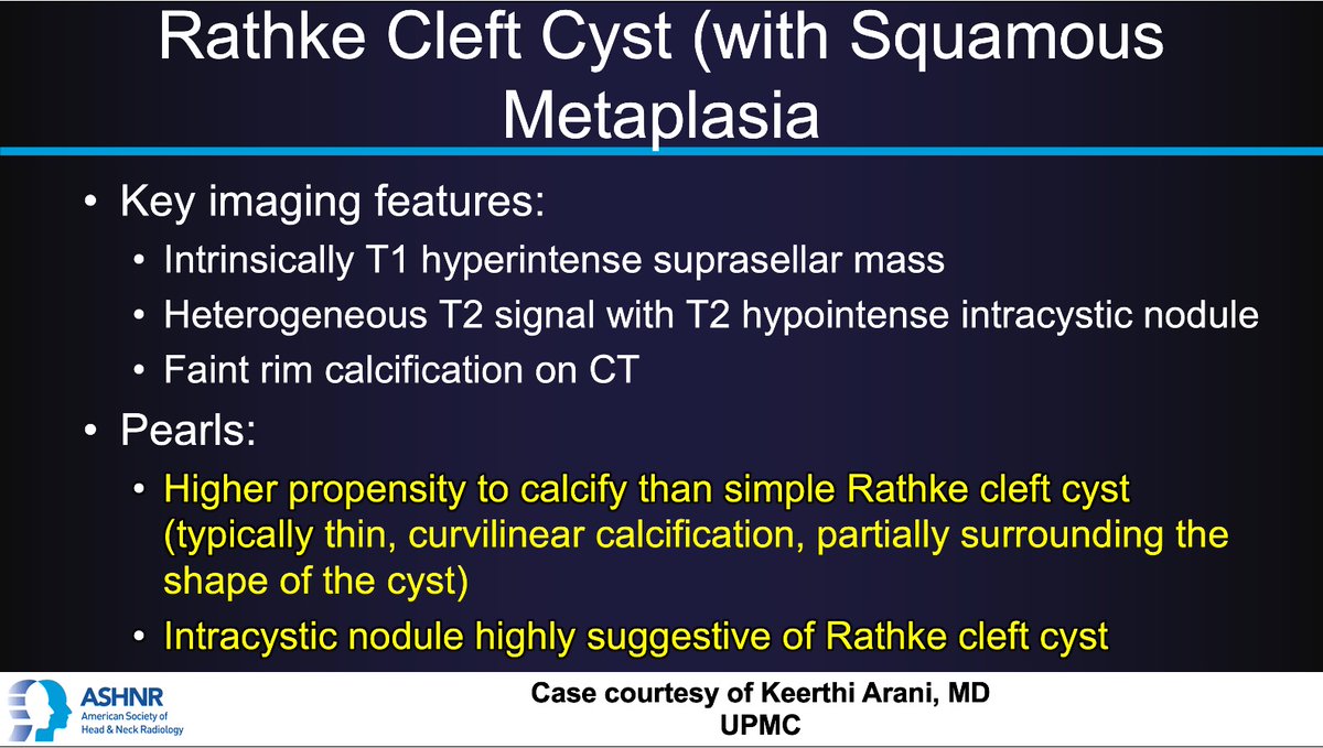 ASHNR (@ashnrsociety) on Twitter photo #ASHNRCOTW #290: ANSWER. Thx Dr.
@keerthiArani 4 case! #ASHNR25
<a href="/callyrobs/">Caroline Robson, MBChB</a> <a href="/DShatzkes/">Deborah Shatzkes</a> <a href="/CDP_Rad/">C Douglas Phillips πΊπΈ</a>
<a href="/rhwiggins/">Richard Wiggins</a> <a href="/nakoontz/">Nicholas Koontz</a> <a href="/KRileyMD/">Kalen Riley</a> <a href="/CMGlastonbury/">Christine M Glastonbury, MD</a>
<a href="/tabby_kennedy/">Tabby A. Kennedy, MD</a> <a href="/PhilipRChapman1/">Philip R. Chapman, MD</a> <a href="/cmtomblinson/">Courtney Tomblinson, MD</a>
<a href="/amyfjuliano/">Amy Juliano</a> <a href="/bpoliceni/">Bruno Policeni</a> <a href="/MohitTCCNeuro/">Mohit Agarwal</a>
<a href="/AshokSrini15/">Ashok Srinivasan</a> <a href="/KatieTraylorDO/">Katie S. Traylor MS, DO, DABR</a> <a href="/CynXinWu/">Cynthia Xin Wu</a> #ASHNRCOTW #290: ANSWER. Thx Dr.
@keerthiArani 4 case! #ASHNR25
<a href="/callyrobs/">Caroline Robson, MBChB</a> <a href="/DShatzkes/">Deborah Shatzkes</a> <a href="/CDP_Rad/">C Douglas Phillips πΊπΈ</a>
<a href="/rhwiggins/">Richard Wiggins</a> <a href="/nakoontz/">Nicholas Koontz</a> <a href="/KRileyMD/">Kalen Riley</a> <a href="/CMGlastonbury/">Christine M Glastonbury, MD</a>
<a href="/tabby_kennedy/">Tabby A. Kennedy, MD</a> <a href="/PhilipRChapman1/">Philip R. Chapman, MD</a> <a href="/cmtomblinson/">Courtney Tomblinson, MD</a>
<a href="/amyfjuliano/">Amy Juliano</a> <a href="/bpoliceni/">Bruno Policeni</a> <a href="/MohitTCCNeuro/">Mohit Agarwal</a>
<a href="/AshokSrini15/">Ashok Srinivasan</a> <a href="/KatieTraylorDO/">Katie S. Traylor MS, DO, DABR</a> <a href="/CynXinWu/">Cynthia Xin Wu</a>
