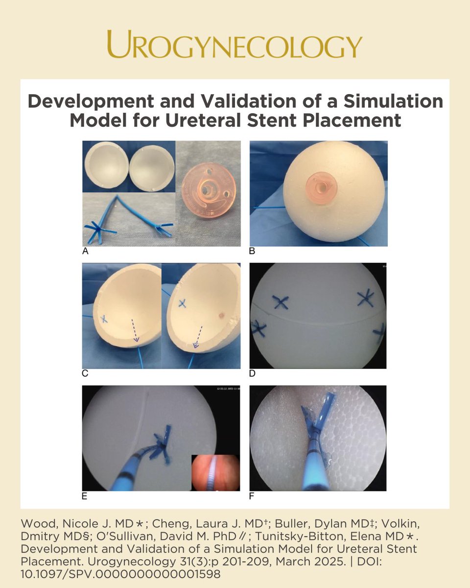 UrogynJournal's tweet image. Need to train your residents in how to place ureteral stents? Check out "Development and Validation of a Simulation Model for Ureteral Stent Placement" for both a low-fidelity and valid model developed by the authors of this paper.
journals.lww.com/fpmrs/fulltext…