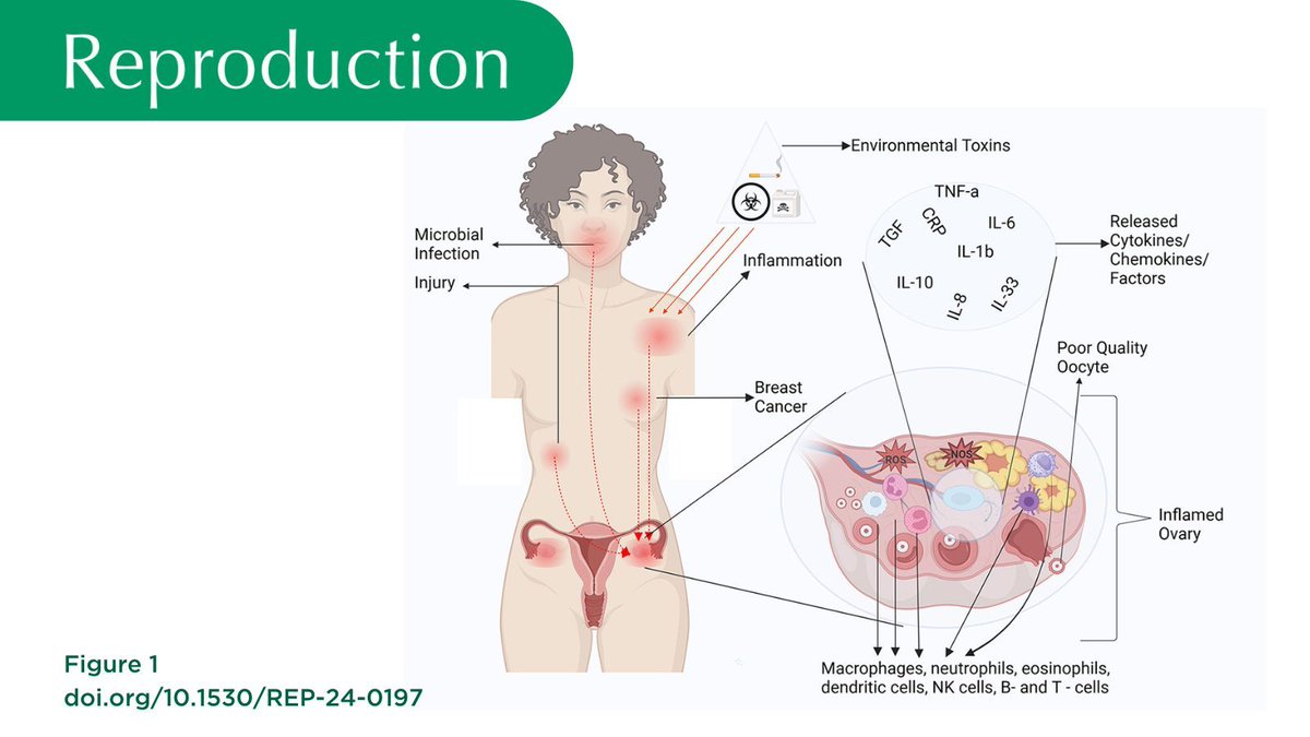 Reproduction journal (@reprodjournal) on Twitter photo This paper reviews the current literature, showing that chronic inflammation has a negative impact on oocyte quality, folliculogenesis, hormone production, immune signaling and other processes that affect fertility in females.
Read it: doi.org/10.1530/REP-24…
<a href="/KlutsteinlbCARL/">Michael Klutstein💔</a> This paper reviews the current literature, showing that chronic inflammation has a negative impact on oocyte quality, folliculogenesis, hormone production, immune signaling and other processes that affect fertility in females.
Read it: doi.org/10.1530/REP-24…
<a href="/KlutsteinlbCARL/">Michael Klutstein💔</a>