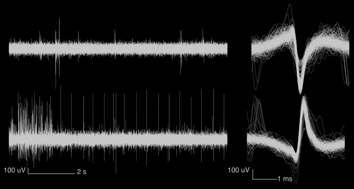 So I suppose this means we are in the NHP ephys game now 

Recorded with flexible thin-film electrodes made in-house by the lab