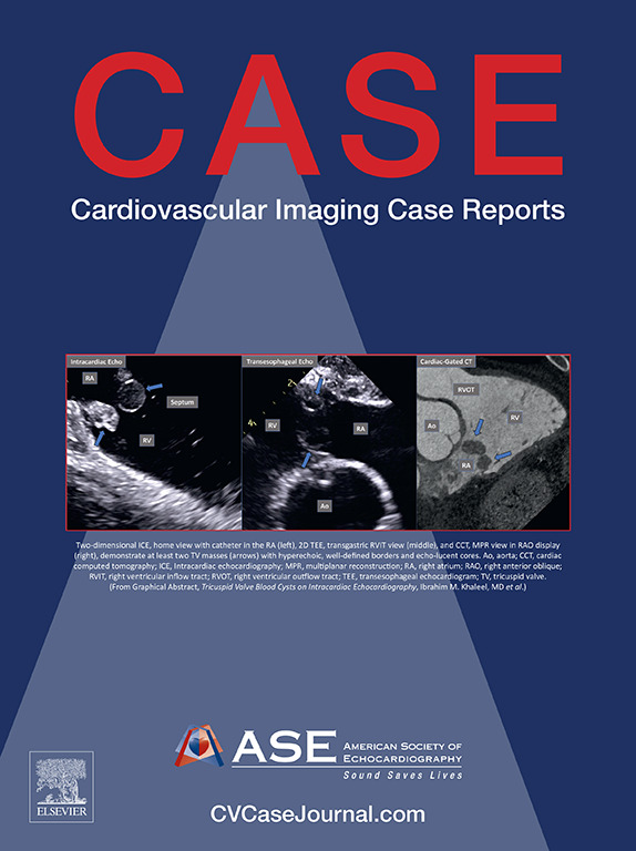 American Society of Echocardiography (@ase360) on Twitter photo Experts in #CVUltrasound provide insightful cases each month for ASE’s open access <a href="/CASEfromASE/">CV Case Journal</a>.
Check out the Sonographer Spotlight and Unlock the Case sections online. Submit your case to be included in a future issue! #HeartofASE #ASEMemberDay #ASE50th #EchoFirst Experts in #CVUltrasound provide insightful cases each month for ASE’s open access <a href="/CASEfromASE/">CV Case Journal</a>.
Check out the Sonographer Spotlight and Unlock the Case sections online. Submit your case to be included in a future issue! #HeartofASE #ASEMemberDay #ASE50th #EchoFirst