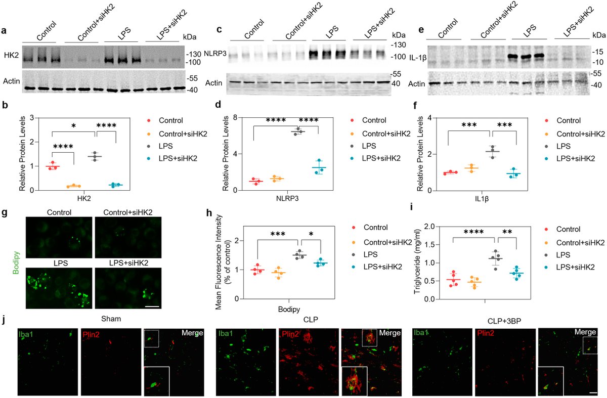 JLR press| Hexokinase 2 Promotes ISGylation of Acyl-CoA Synthetase Long-chain Family Member 4 in Sepsis-Induced Microglia Cells.
Learn more:
jlr.org/article/S0022-…