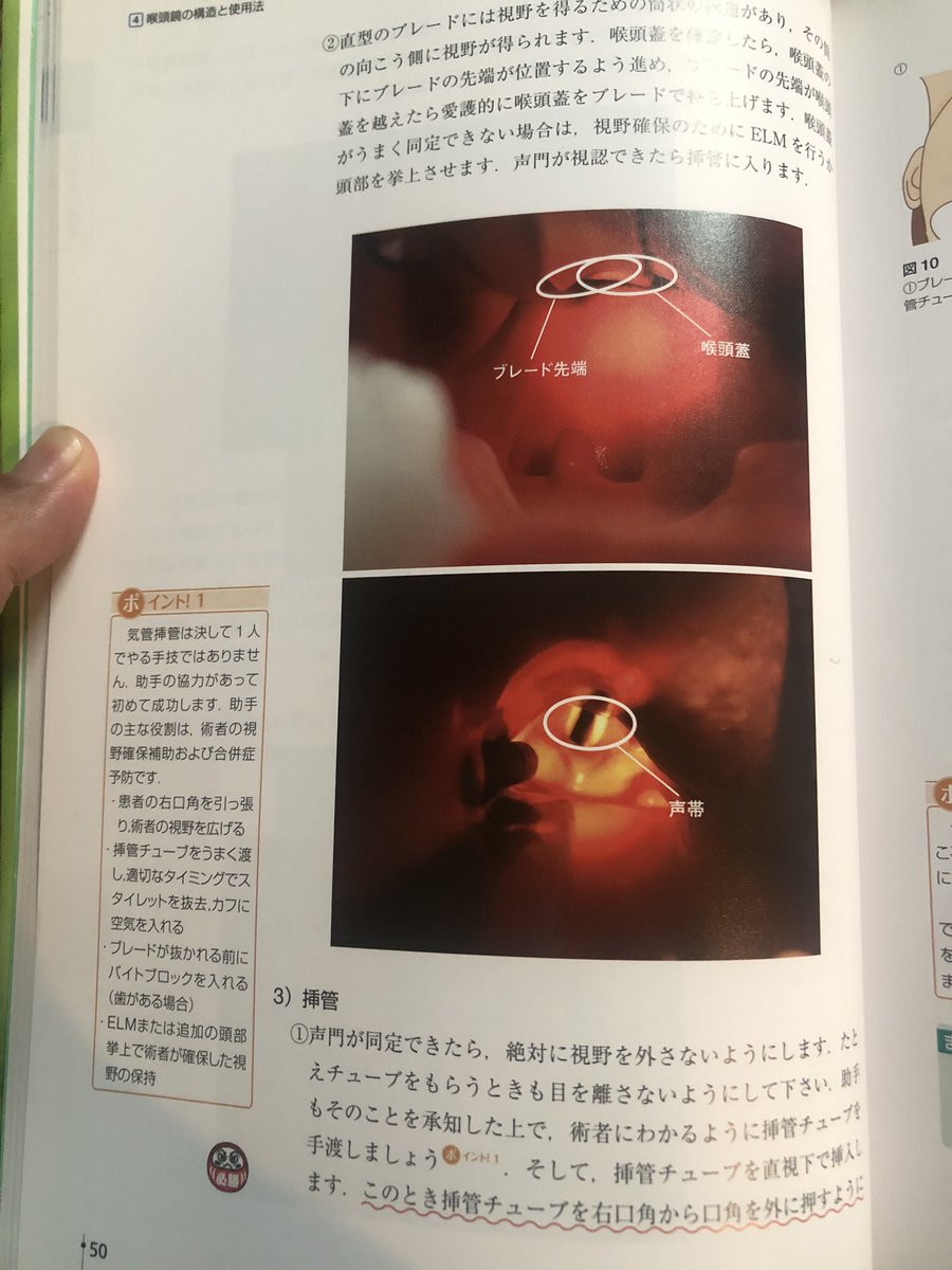 【裁断済み】気道管理大全 Evidence and Tips m3電子書籍 | 気道管理大全 ―Evidence and Tips―