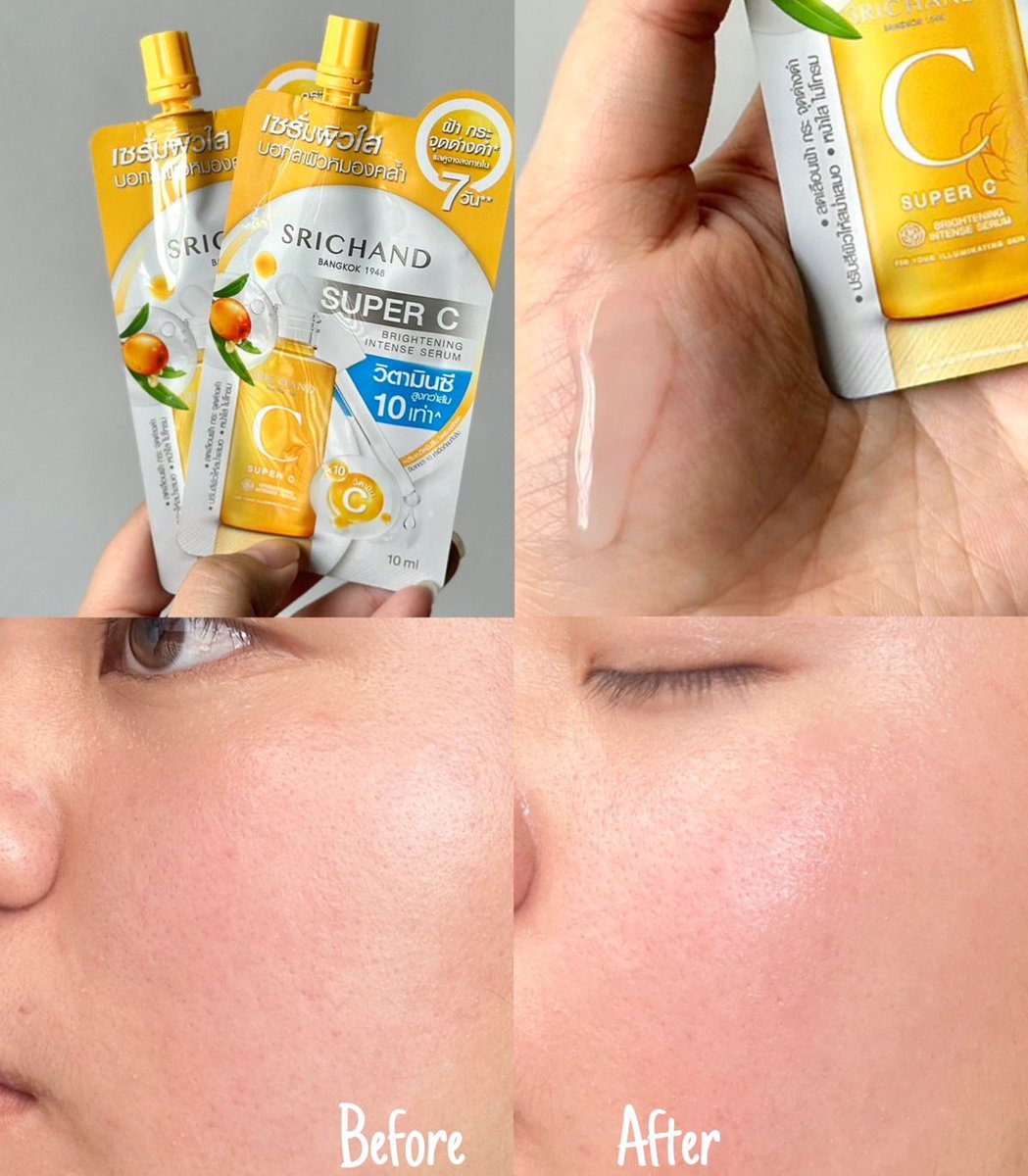 ครีมซองที่ตัวแม่เค้าต้องมีกัน SUPER C BRIGHTENING INTENSE SERUM ผิวกระจ่างใสขั้นสุดในราคาหลักสิบ!! อมกกก ละคือใช้แล้วหน้ากระจ่างใสขึ้นจริง ช่วยลดจุดต่างดำ ปรับสีผิวหน้าในสม่ำเสมอเนื้อเซรั่มบางเบา 10/10 กลายเป็นเซรั่มซองลูกรักไปแล้ว พิกัด 7-11 ราคาซองละ 39 บาท
#ใช้ดีบอกต่อ