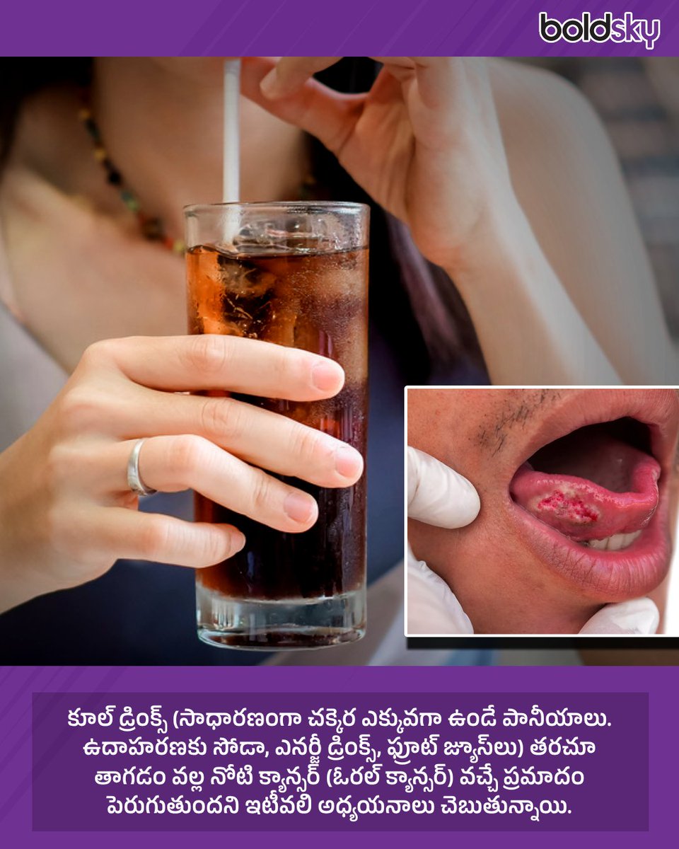 BoldskyTelugu's tweet image. కూల్ డ్రింక్స్ అతిగా తాగుతున్నారా..?
#Cooldrinks #Cancer #Oralcancer #Healthbenfits #HealthyEating #HealthyFood #HealthTips #HealthyLifestyle #StayHealthy #HealthUpdates #BoldSkyTelugu