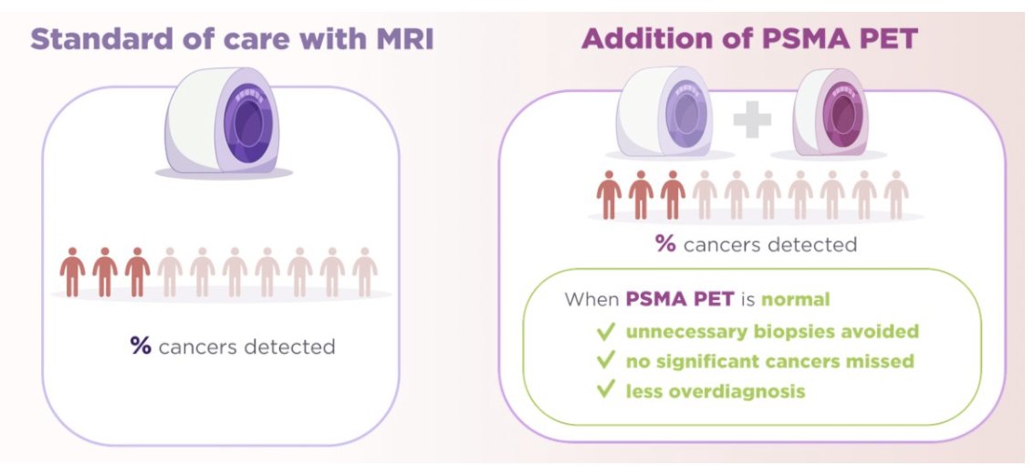 UroToday.com (@urotoday) on Twitter photo #PRIMARY Score and where it plays a role. <a href="/DrMHofman/">Michael Hofman</a> <a href="/PeterMacCC/">Peter Mac Cancer Centre</a>. Written coverage by <a href="/zklaassen_md/">Zach Klaassen</a> <a href="/GACancerCenter/">Georgia Cancer Center</a> > bit.ly/3XEDpg5 <a href="/PCFnews/">Prostate Cancer Foundation</a> <a href="/PSMAconference/">PSMA & Beyond Conference</a> #PSMAandBeyond2025 #PRIMARY Score and where it plays a role. <a href="/DrMHofman/">Michael Hofman</a> <a href="/PeterMacCC/">Peter Mac Cancer Centre</a>. Written coverage by <a href="/zklaassen_md/">Zach Klaassen</a> <a href="/GACancerCenter/">Georgia Cancer Center</a> > bit.ly/3XEDpg5 <a href="/PCFnews/">Prostate Cancer Foundation</a> <a href="/PSMAconference/">PSMA & Beyond Conference</a> #PSMAandBeyond2025